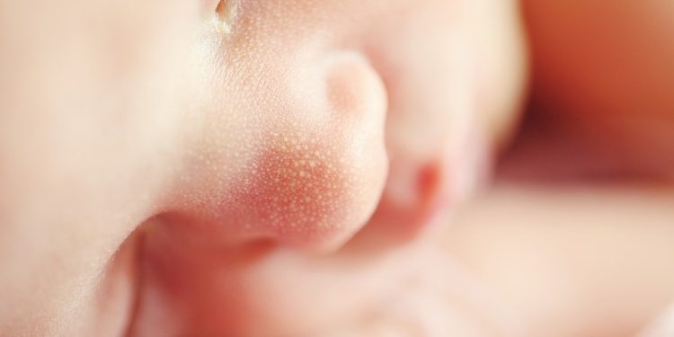 Soothing Solutions: Natural Infant Teething Remedies for Happy Babies 34 Soothing Solutions: Natural Infant Teething Remedies for Happy Babies