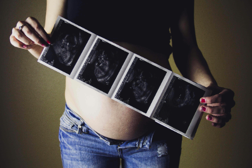 The Miracle of Life: A Journey Through Fetal Development 35 The Miracle of Life: A Journey Through Fetal Development