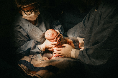 The Miracle of Modern Medicine: The Life-Saving Benefits of Cesarean Sections 35 The Miracle of Modern Medicine: The Life-Saving Benefits of Cesarean Sections